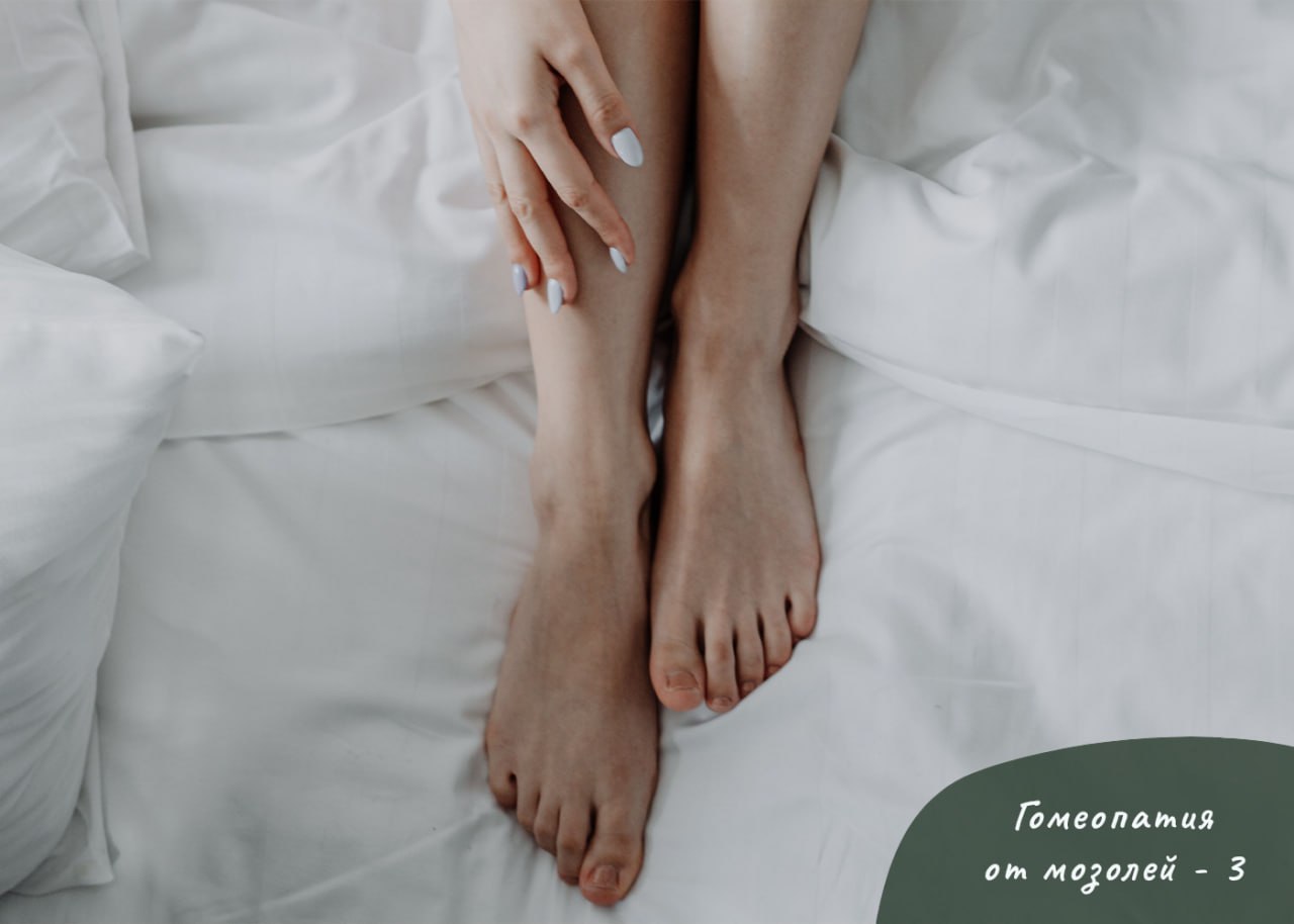 ГОМЕОПАТИЯ ОТ МОЗОЛЕЙ - ТРЕТЬЯ ЧАСТЬ ГОМЕОПАТИЯ ОТ МОЗОЛЕЙ - ТРЕТЬЯ ЧАСТЬ