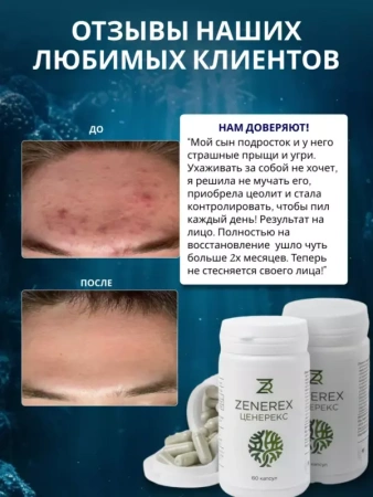 Картинка цеолит для проблемной кожи  от интернет-аптеки mosgomeopat.ru