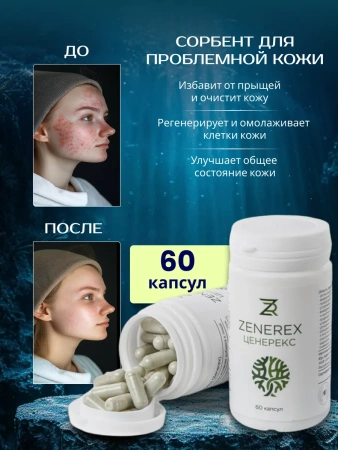 Картинка цеолит для проблемной кожи  от интернет-аптеки mosgomeopat.ru